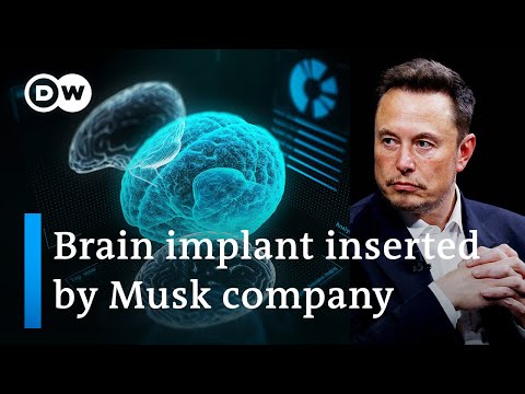 Elon Musk's start-up Neuralink implants first chip in human brain | DW News