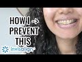 STOP Your Teeth From Looking YELLOW on Invisalign