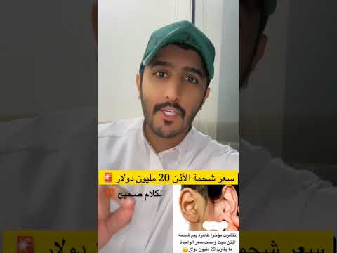 ظاهره بيع لحمه الأذن في الخارج سعره 20مليون دولار الذي يبغى يبيع لحمته يكتب بالكومتن اكسبلور