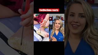 Doctor Reacts To Callus Shaving Device