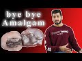 Why Should I Stop Using Amalgam ليش الاطباء توقفو عن استخدام الاملغم 