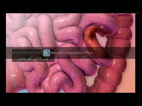 الحركة الدودية