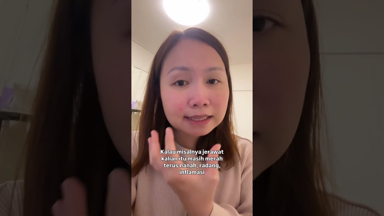 Treatment Jerawat di Jepang harus kemana?