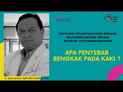 Apa Penyebab Bengkak Pada kaki? oleh dr. Dono Antono, SpPD-KKV, FINASIM, FICA