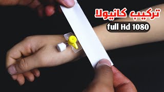 أجمل تركيب كانيولا_تركيب كانيولا بدقه عاليه full hd1080_ Best cannula insertion