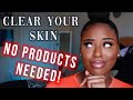 HOW TO: CLEAR Your Skin WITHOUT Using ANY PRODUCTS FAST!!! | For Acne Prone Skin|| LexsaMarie