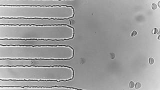 Deformation of red blood cells