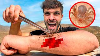 ‼️Picado por ARAÑA DEL RINCON‼️ (Especial 6 Millones) - Peores Picaduras #23