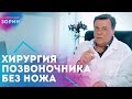 ХИРУРГИЯ межпозвонковых дисков БЕЗ НОЖА. Нейрохируг Зорин Николай Александрович