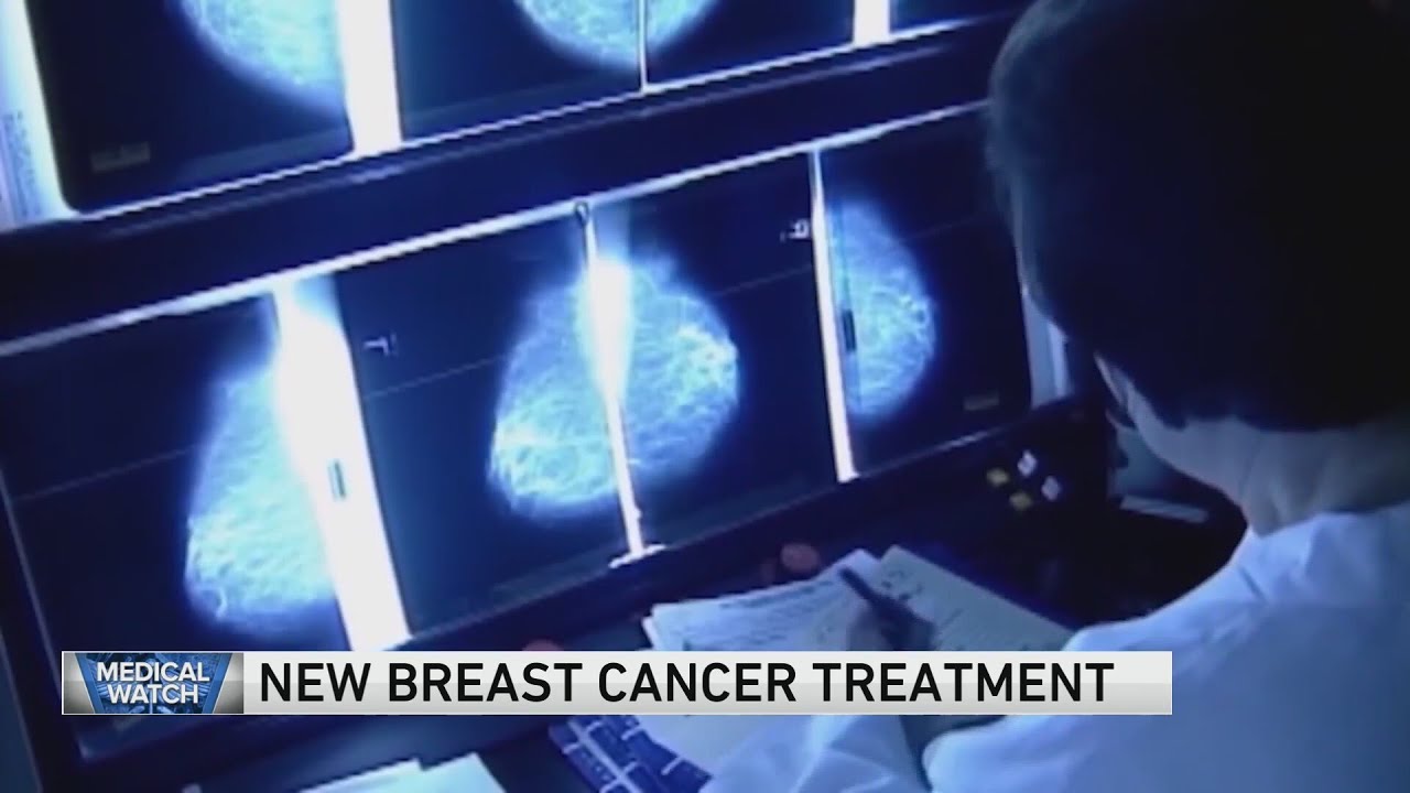 New Breast Cancer Treatment — and more headlines - YouTube