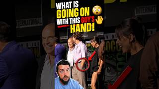 What Is Going On With This Guy’s HAND?! 😳✋