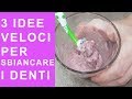 SBIANCARE I DENTI GRATIS O QUASI CON 3 RIMEDI VELOCISSIMI ED ECONOMICI | FoodVlogger