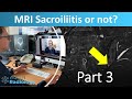 Sacroiliitis or not?  with Prof. Hermann - Part 3