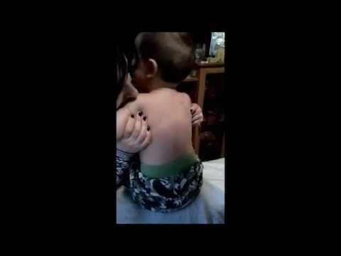 астма . детский массаж , иглоукалывание