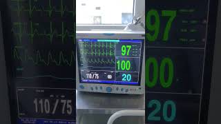 Human cardiography vital monitoring & support the ventilation trending care patient viral new
