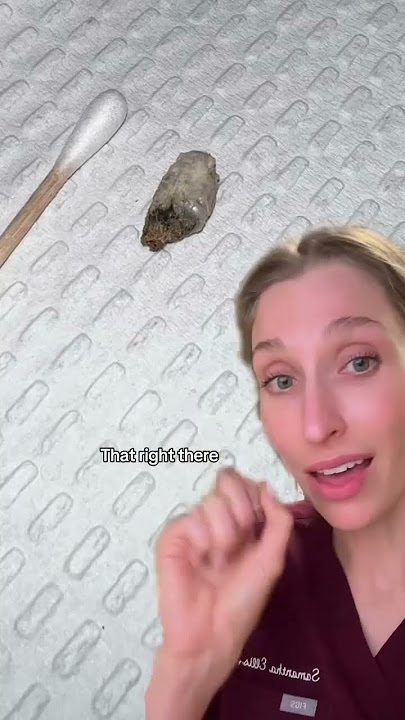 Did you remember to clean your belly button today?
