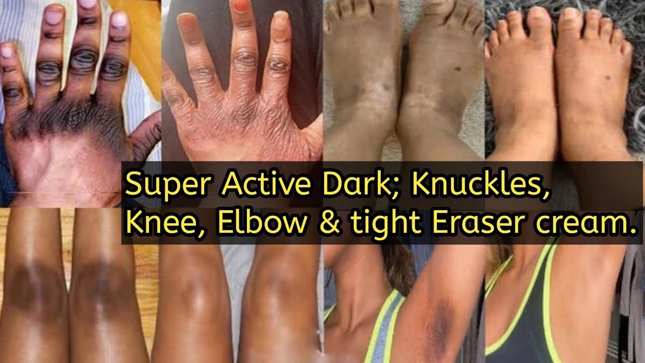 Быстродействующая техника Promixing для придания темного оттенка суставам пальцев, коленям, локтя...