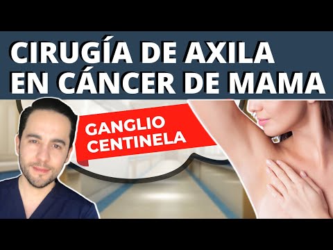 Video: ¿Un bulto en mi axila podría ser cáncer?