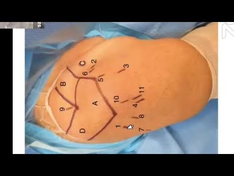 Arthroscopic Anatomy of the Shoulder