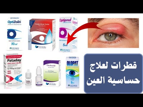 ازاى اعرف شكل حساسية العين اسباب واعراض وعلاج حساسية العين