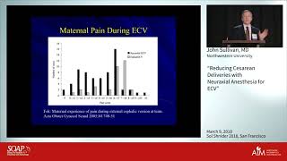 Reducing Cesarean Deliveries with Neuraxial Anesthesia for ECV - John Sullivan, M.D