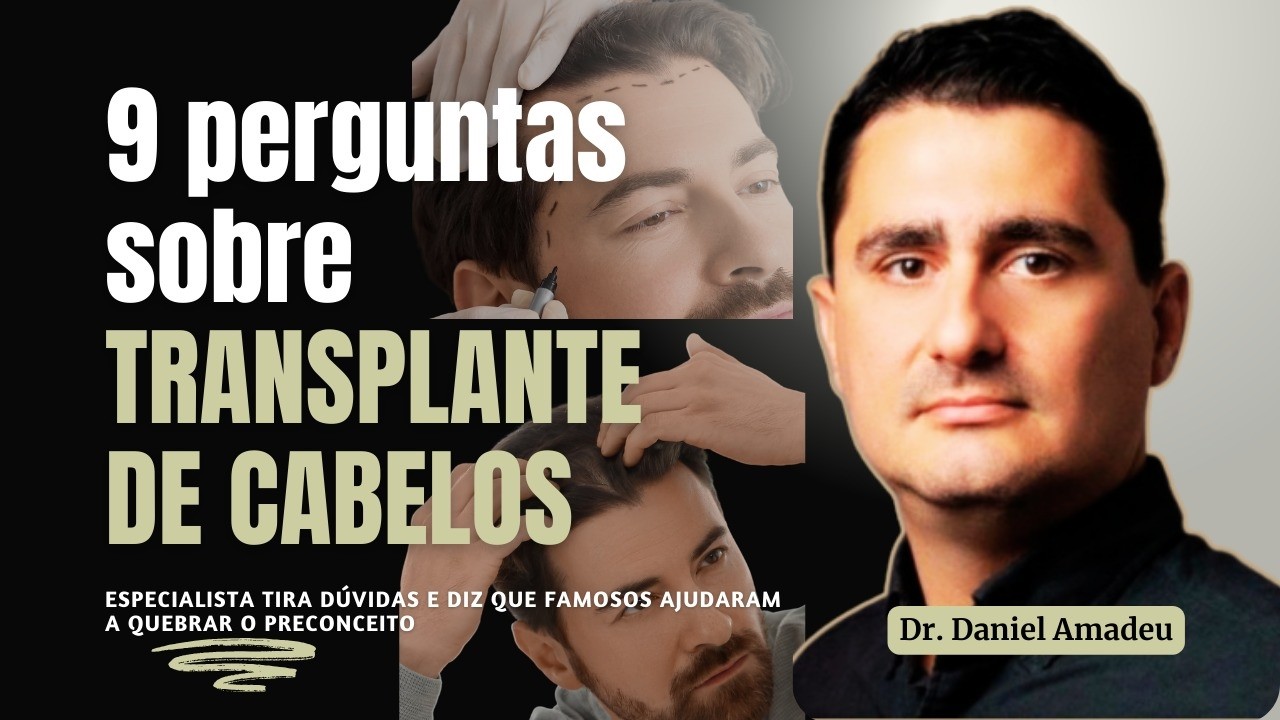 TRANSPLANTE DE CABELO: evolução do tratamento atrai pacientes cada vez mais jovens