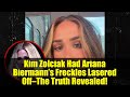 Kim Zolciak Had Ariana Biermann’s Freckles Lasered Off—The Truth Revealed!