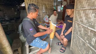 Kaki Palsu Baru Datang Malah Lanjut Part 2 Laka Bareng Hilal Sdanai Masuk Meja Oprasi Lagi  