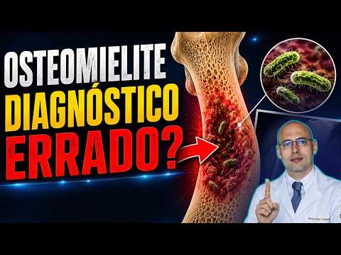 The Most Common Mistake in Diagnosing Osteomyelitis! thumbnail