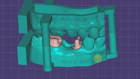 Simple tip: Exocad model creator old version