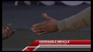 This is insane, her hand is growing!?#faith #Jesus