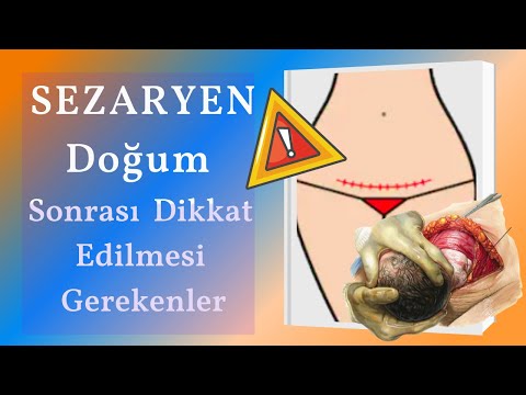 Video: Sezaryen Sonrası Doğum Nasıl Olur?