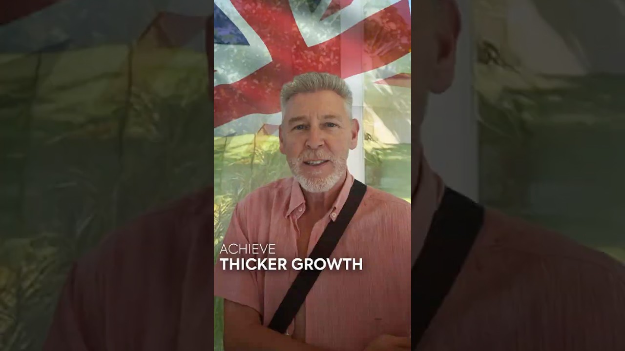 Hair Transplant Turkey | Hair Journey of Ronald