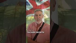 Hair Transplant Turkey Hair Journey Of Ronald