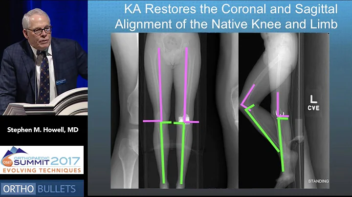 Pro: Kinematic Alignment Is All That Matters! - St...