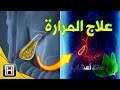 اعراض المرارة وعلاجها بستة اعشاب.  كل ما يجب أن تعرفه عن حصى المرارة