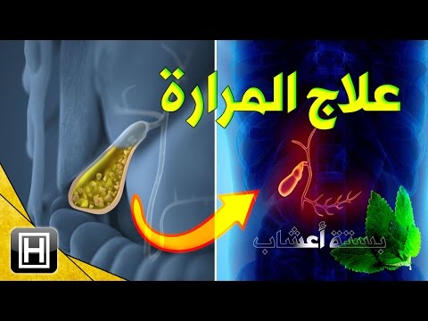 اعراض المرارة وعلاجها بستة اعشاب ومعلومات مهمة عن حصى المرارة