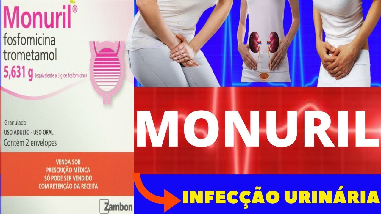 MONURIL - PARA QUE SERVE, COMO USAR, COMO FUNCIONA, EFEITOS COLATERAIS ...