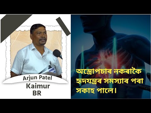 অস্ত্ৰোপচাৰ নকৰাকৈ হৃদযন্ত্ৰৰ সমস্যাৰ পৰা সকাহ পালে। Arjun Patel, Kaimur (BR)