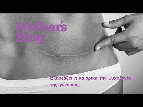 Βίντεο: Πώς να απαλλαγείτε από την κοιλιά μετά από καισαρική τομή