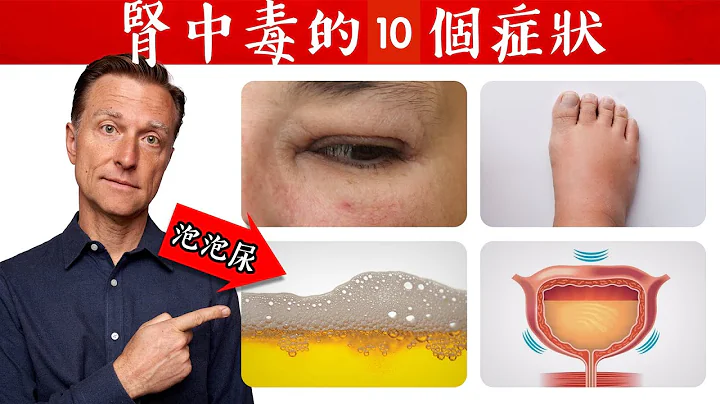 肾中毒的10个症状,自然疗法,柏格医生 Dr Berg - 天天要闻