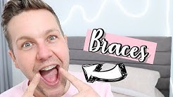 10 THINGS TO KNOW BEFORE GETTING A BRACE | 6 MONTH SMILE