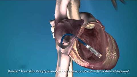 The Medtronic Micra—the World