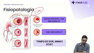 SINDROME CORONARIANA AGUDA atualizada