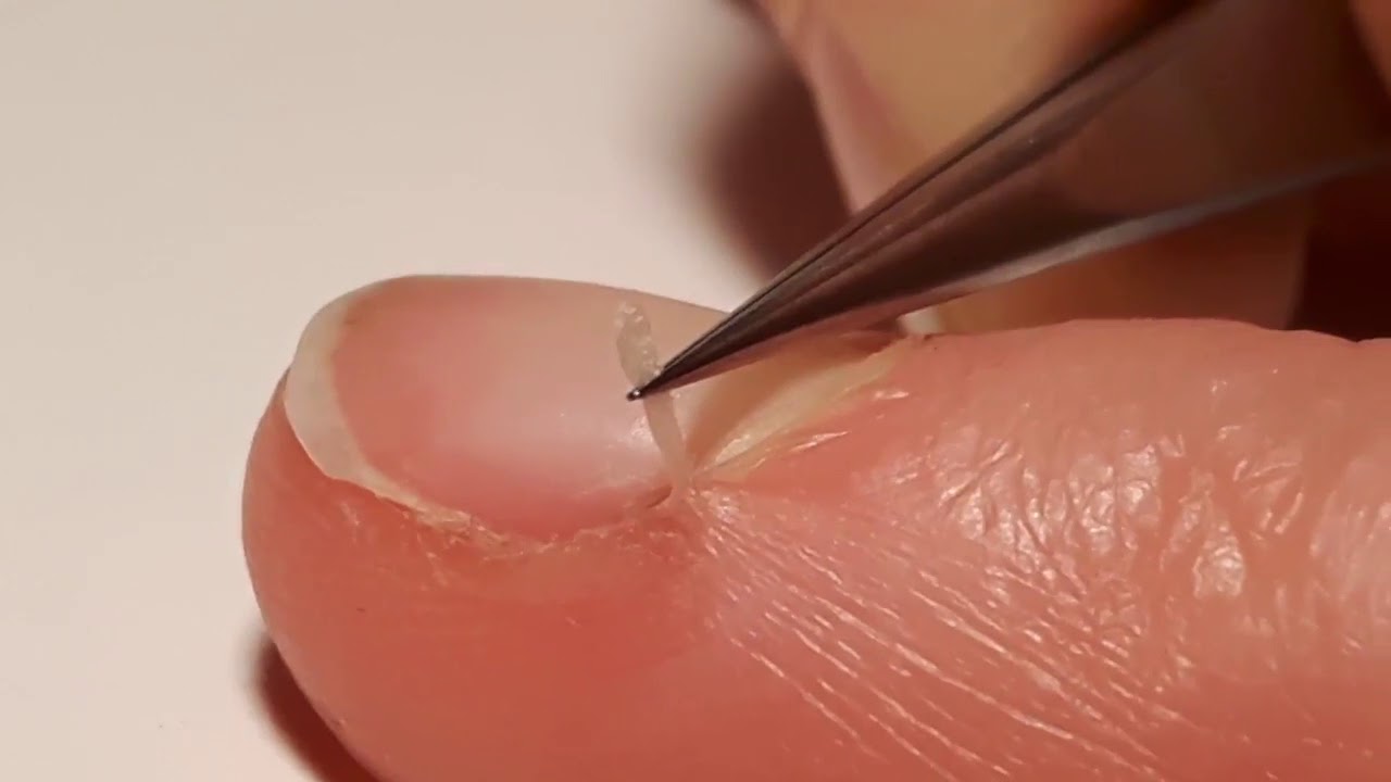 Most Precise Tweezers on Earth