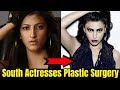 South Indian Actresses Before and After Plastic Surgery | Tamil Actress Plastic Surgery