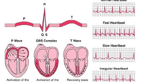 ECG analysis with DSO
