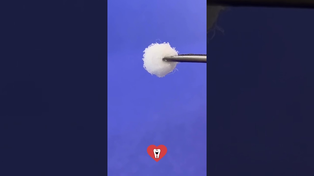 SPRAY -50oC PARA TESTE FRIO NO DENTE [cold test] 