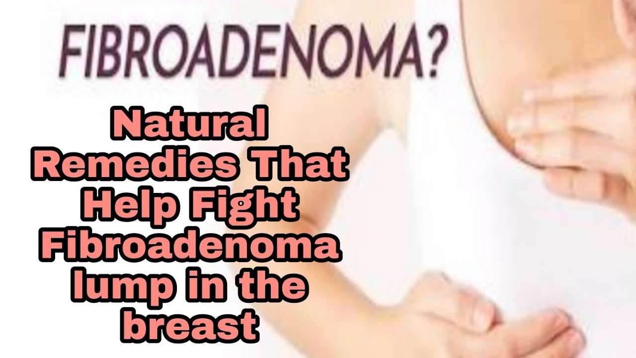 ब्रैस्ट में गांठ Fibroadenoma of the breast Symptoms, treatment