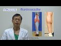 Lih-Ren Clinic - Calf reduction(part 1)-The causes of thick calves